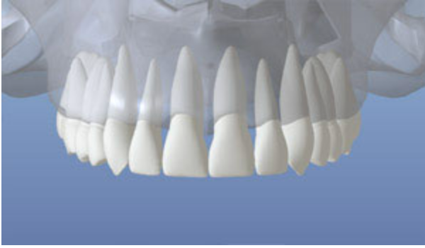 3D illustration of a normal healthy jaw with full set of teeth